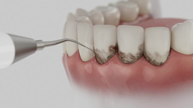 Trusted Dental Implants service in St. Louis Park, MN - Dentist Open Now